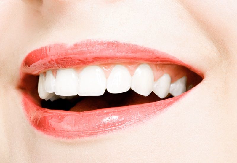 Cosmetic Dentistry Procedures for the Ultimate Smile Makeover